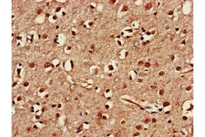 Immunohistochemistry of paraffin-embedded human brain tissue using ABIN7171556 at dilution of 1:100 (TAF1A antibody  (AA 251-325))