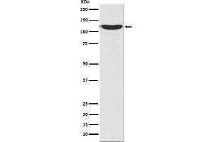 Western blot analysis of PKN2 in 293T cell lysate.
