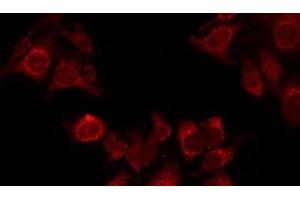 ABIN6276428 staining LOVO by IF/ICC. (RAN antibody  (C-Term))
