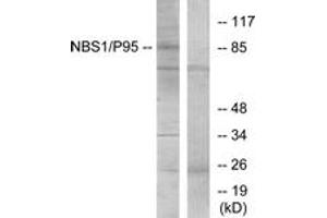 Western blot analysis of extracts from Jurkat cells, using p95/NBS1 (Ab-343) Antibody. (Nibrin antibody  (AA 310-359))