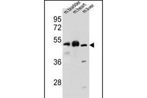 BTBD17 Antibody (C-term) (ABIN655567 and ABIN2845068) western blot analysis in mouse bladder,heart,liver tissue lysates (35 μg/lane). (BTBD17 antibody  (C-Term))