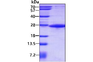 SDS-PAGE (SDS) image for E3 Ubiquitin-Protein Ligase SIAH1 (SIAH1) (AA 90-282) protein (His tag) (ABIN1098362)
