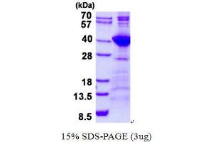 Image no. 1 for NEK7 (NEK7) protein (His tag) (ABIN1098444) (NEK7 Protein (NEK7) (His tag))