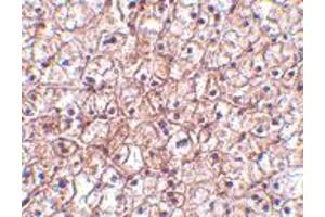 Immunohistochemistry of IFNB1 in human liver tissue with IFNB1 polyclonal antibody  at 5 ug/mL . (IFNB1 antibody  (Internal Region))
