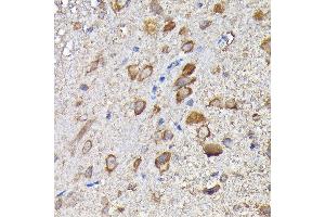 Immunohistochemistry of paraffin-embedded mouse spinal cord using MTHFD1L Rabbit pAb (ABIN6132366, ABIN6144142, ABIN6144143 and ABIN6223977) at dilution of 1:200 (40x lens). (MTHFD1L antibody  (AA 759-978))