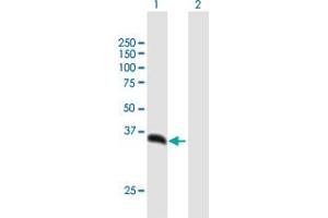 Western Blot analysis of PSMD14 expression in transfected 293T cell line by PSMD14 MaxPab polyclonal antibody. (PSMD14 antibody  (AA 1-310))