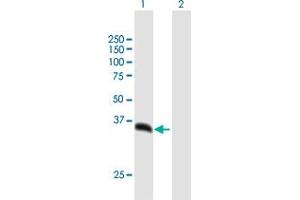 Western Blot analysis of PSMD14 expression in transfected 293T cell line by PSMD14 MaxPab polyclonal antibody. (PSMD14 antibody  (AA 1-310))