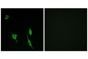 Immunofluorescence (IF) image for anti-Deleted in Colorectal Carcinoma (DCC) (Internal Region) antibody (ABIN1850422)