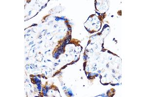 Immunohistochemistry of paraffin-embedded Human placenta using p38 MAPK Rabbit pAb (ABIN7268616) at dilution of 1:100 (40x lens). (MAPK14 antibody  (C-Term))
