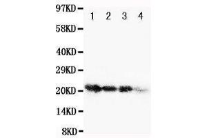 Anti-human FGF1 antibody, Western blotting Lane 1: Recombinant Human FGF1 Protein 10ng Lane 2: Recombinant Human FGF1 Protein 5ng Lane 3: Recombinant Human FGF1 Protein 2