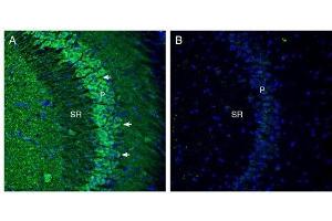 Expression of Cortactin in mouse hippocampus. (Cortactin (CTTN) Peptide)