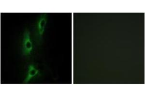 Immunofluorescence analysis of NIH-3T3 cells, using ADRB2 Antibody. (beta 2 Adrenergic Receptor antibody  (AA 201-250))
