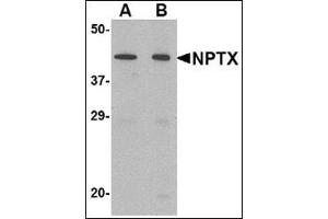Western blot analysis of NPTX2 in mouse brain tissue lysate with this product at (A) 0. (NPTX2 antibody  (Center))