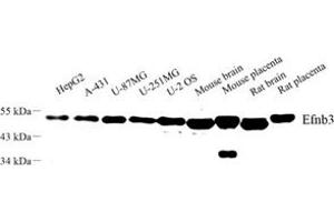 Western blot analysis of Efnb3 (ABIN7073845) at dilution of 1: 500 (Ephrin B3 antibody)