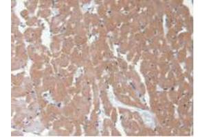 IHC-P analysis of Rat Heart Tissue, with DAB staining. (CAMK2A antibody  (AA 1-478))