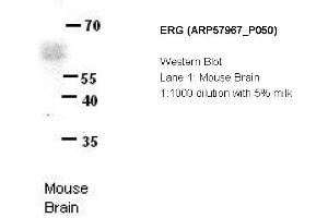 Image no. 2 for anti-ERG, ETS transcription factor (ERG) (N-Term) antibody (ABIN406640) (ERG antibody  (N-Term))