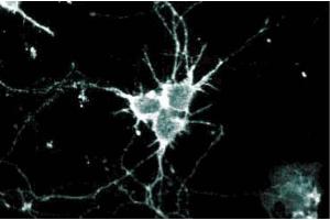 Immunofluorescence staining of rat neurons at 5 µg/ml of the anti-Ral A antibody. (rala antibody  (AA 35-206))