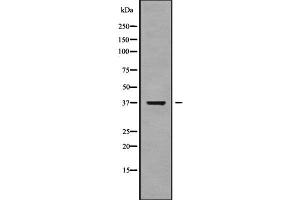 Western blot analysis NEIL2 using HuvEc whole cell lysates (NEIL2 antibody  (Internal Region))