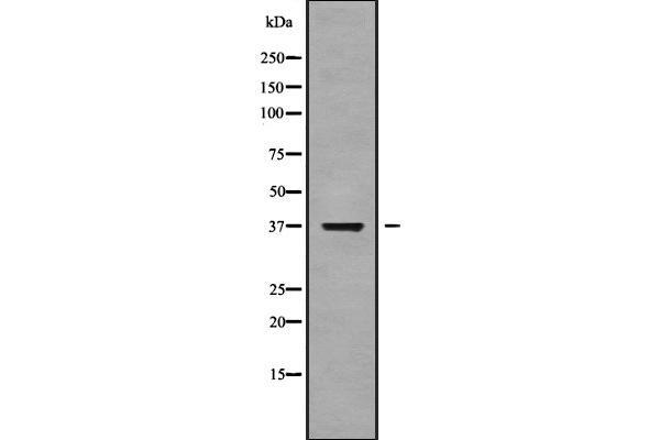 NEIL2 antibody  (Internal Region)