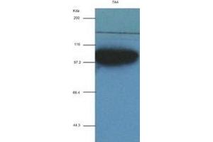 ACTN1 antibody (7A4) at 1:2000 + recombinant human ACTN1 (ACTN1 antibody  (AA 650-893))