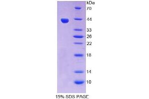 SDS-PAGE (SDS) image for Chemokine (C-X-C Motif) Ligand 17 (CXCL17) (AA 23-119) protein (His tag,GST tag) (ABIN6237763) (CXCL17 Protein (AA 23-119) (His tag,GST tag))
