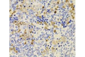 Immunohistochemistry of paraffin-embedded Rat spleen using PRDM5 Polyclonal Antibody at dilution of 1:100 (40x lens). (PRDM5 antibody)