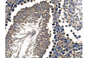 ABIN6261894 and ABIN6268716 at 1/100 staining Rat testis tissue by IHC-P.
