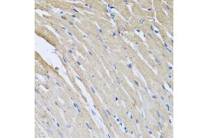 Immunohistochemistry of paraffin-embedded rat heart using CRHBP antibody (ABIN6129571, ABIN6139030, ABIN6139033 and ABIN6222243) at dilution of 1:100 (40x lens). (CRHBP antibody  (AA 25-322))
