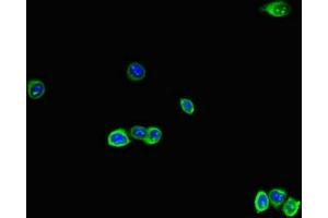 Immunofluorescent analysis of HepG2 cells using ABIN7167280 at dilution of 1:100 and Alexa Fluor 488-congugated AffiniPure Goat Anti-Rabbit IgG(H+L) (RAB28 antibody  (AA 98-218))