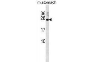 Western Blotting (WB) image for anti-RAP2C, Member of RAS Oncogene Family (RAP2C) antibody (ABIN3001185)
