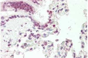 Human, Lung: Formalin-Fixed Paraffin-Embedded (FFPE) (DNAJB1 antibody  (AA 74-123))