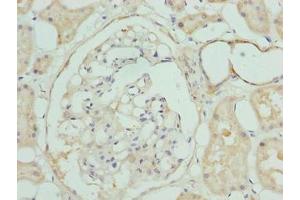 Immunohistochemistry of paraffin-embedded human kidney tissue using ABIN7147805 at dilution of 1:100 (CLYBL antibody  (AA 23-340))