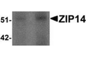 Western blot analysis of ZIP14 in human spleen tissue lysate with ZIP14 antibody at (left) 1 and (right) 2 μg/ml. (SLC39A14 antibody  (Center))