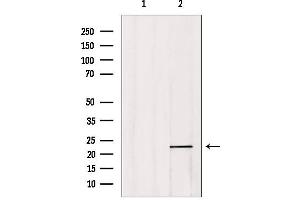 Western blot analysis of extracts from 293, using CBF β Antibody. (CBFB antibody  (N-Term))