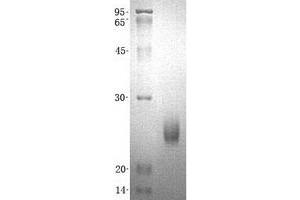 Validation with Western Blot (ITPA Protein (Transcript Variant 1) (His tag))
