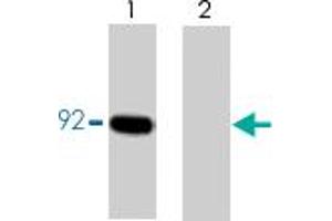 Western blot analysis of CTNNB1 immunoprecipitated from lysates prepared from A-431 cells treated with pervanadate. (CTNNB1 antibody  (pTyr86))