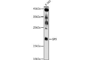 Western blot analysis of extracts of K-562 cells, using GP9 antibody (ABIN6127598, ABIN6141293, ABIN6141294 and ABIN6221019) at 1:500 dilution. (CD42a antibody  (AA 17-147))