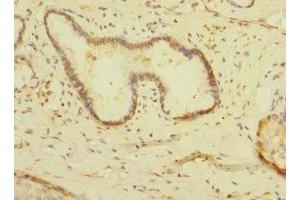 Immunohistochemistry (IHC) image for anti-Membrane Protein, Palmitoylated 6 (MAGUK P55 Subfamily Member 6) (MPP6) (AA 220-420) antibody (ABIN7158909)