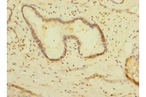 Immunohistochemistry of paraffin-embedded human pancreatic tissue using ABIN7158909 at dilution of 1:100 (MPP6 antibody  (AA 220-420))