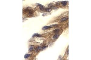 Immunohistochemistry of TRIF in human lung tissue with this product at 10 μg/ml. (TICAM1 antibody  (C-Term))