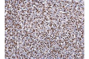 IHC-P Image ZAP70 antibody detects ZAP70 protein at nucleus on mouse lymph node by immunohistochemical analysis. (ZAP70 antibody  (Center))