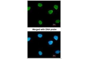 ICC/IF Image Immunofluorescence analysis of paraformaldehyde-fixed HeLa, using PARP1, antibody at 1:200 dilution. (PARP1 antibody)