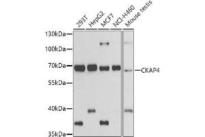 Western blot analysis of extracts of various cell lines, using CK antibody (ABIN6134474, ABIN6138645, ABIN6138646 and ABIN6223731) at 1:500 dilution. (CKAP4 antibody)