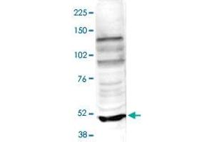 Nuclear extracts of HeLa cells (40 ug) were analysed by Western blot using TASP1 polyclonal antibody  diluted 1 : 500 in TBS-Tween containing 5% skimmed milk. (TASP1 antibody)