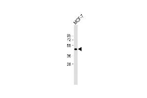 Anti-ETS2 Antibody (Center) at 1:2000 dilution + MCF-7 whole cell lysate Lysates/proteins at 20 μg per lane. (ETS2 antibody  (AA 146-173))