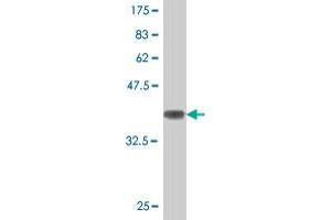 Western Blot detection against Immunogen (36. (ATG5 antibody  (AA 176-275))