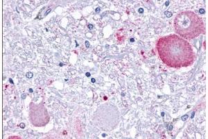Anti-GPR34 antibody  ABIN1048802 IHC staining of human brain, neurons and glia. (GPR34 antibody)