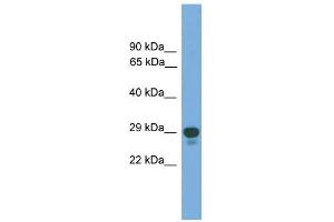 WB Suggested Anti-PRRX2 Antibody Titration: 0. (PRRX2 antibody  (Middle Region))