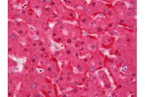 Immunohistochemistry (Paraffin-embedded Sections) (IHC (p)) image for anti-phosphoenolpyruvate Carboxykinase 1 (Soluble) (PCK1) antibody (HRP) (ABIN2582824)