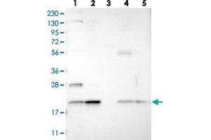 Western blot analysis of Lane 1: RT-4, Lane 2: U-251 MG, Lane 3: Human Plasma, Lane 4: Liver, Lane 5: Tonsil with TMEM65 polyclonal antibody  at 1:250-1:500 dilution.